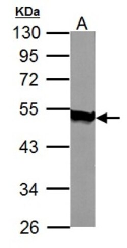 Acylglycerol Kinase Antibody, Novus Biologicals 0.1mL; Unlabeled:Antibodies,