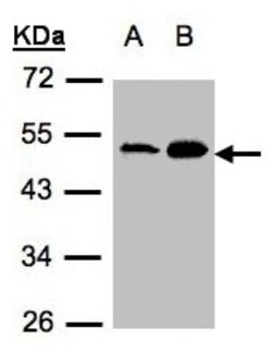Acylglycerol Kinase Antibody, Novus Biologicals 0.1mL; Unlabeled:Antibodies,