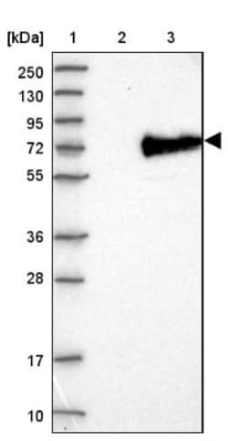 Acyloxyacyl Hydrolase Antibody, Novus Biologicals 0.1mL; Unlabeled:Antibodies,