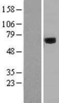 Novus Biologicals&trade;&nbsp;Acyloxyacyl Hydrolase Overexpression Lysate