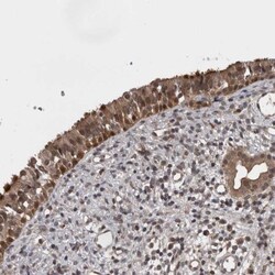Acyloxyacyl Hydrolase Antibody, Novus Biologicals 0.1mL; Unlabeled:Antibodies,