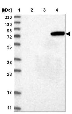 Acyloxyacyl Hydrolase Antibody, Novus Biologicals 25 &mu;L, Unlabeled:Antibodies,