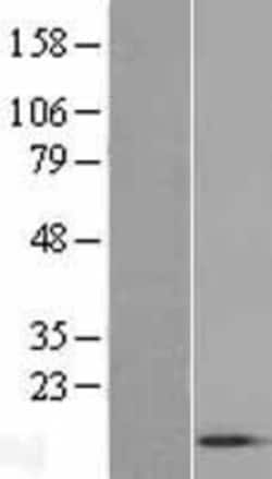 Novus Biologicals&trade;&nbsp;ACYP1 Overexpression Lysate
