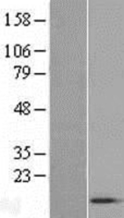 Novus Biologicals ACYP1 Overexpression Lysate 0.1 mg | Buy Online | Novus Biologicals&trade; | Fisher Scientific