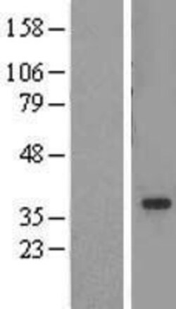 Novus Biologicals&trade;&nbsp;ADA2a Overexpression Lysate
