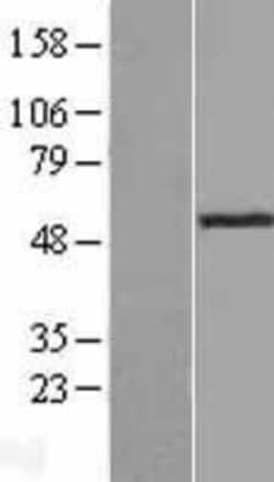 Novus Biologicals&trade;&nbsp;ADA2a Overexpression Lysate