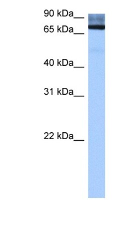ADAD2 Antibody, Novus Biologicals:Antibodies:Primary Antibodies