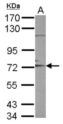 ADAM10 Antibody, Novus Biologicals 0.1mL; Unlabeled:Antibodies, Polyclonal