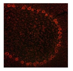 ADAM15 Antibody, Novus Biologicals 100&mu;L; Unlabeled:Antibodies, Polyclonal