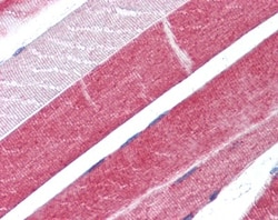 ADAM15 Antibody, Novus Biologicals 0.1 mL | Buy Online | Novus Biologicals | Fisher Scientific