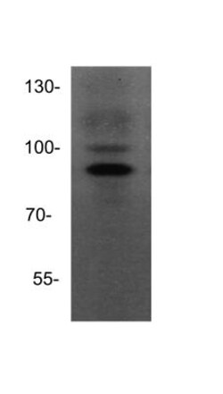 ADAM15 Antibody, Novus Biologicals 100&mu;L; Unlabeled:Antibodies, Polyclonal