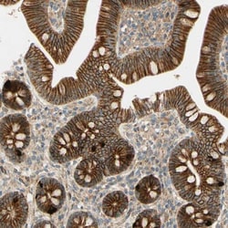 TACE/ADAM17 Antibody, Novus Biologicals 0.1mL; Unlabeled:Antibodies, Polyclonal