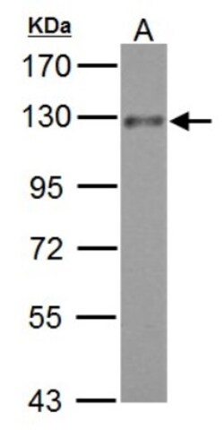 TACE/ADAM17 Antibody, Novus Biologicals 0.1mL; Unlabeled:Antibodies, Polyclonal