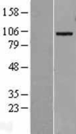 Novus Biologicals™ ADAM19 Overexpression Lysate