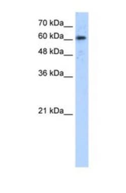 ADAM30 Antibody, Novus Biologicals 0.1mg; Unlabeled:Antibodies, Polyclonal
