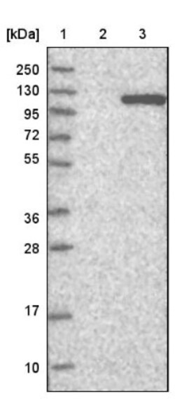 ADAM30 Antibody, Novus Biologicals 0.1mL; Unlabeled:Antibodies, Polyclonal