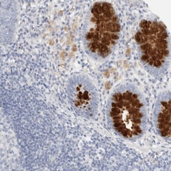ADAM30 Antibody, Novus Biologicals 0.1mL; Unlabeled:Antibodies, Polyclonal