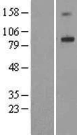 Novus Biologicals&trade;&nbsp;ADAM32 Overexpression Lysate