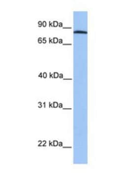ADAM7 Antibody, Novus Biologicals 0.05mg; Unlabeled:Antibodies, Polyclonal