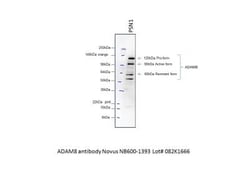 ADAM8 Antibody, Novus Biologicals 0.025 mg, Unconjugated:Antibodies, Polyclonal