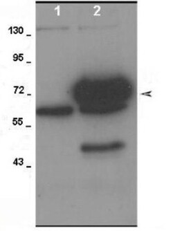ADAM9 Antibody, Novus Biologicals 100&mu;L; Unlabeled:Antibodies, Polyclonal