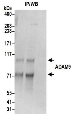 ADAM9 Antibody, Novus Biologicals 0.1mg; Unlabeled:Antibodies, Polyclonal