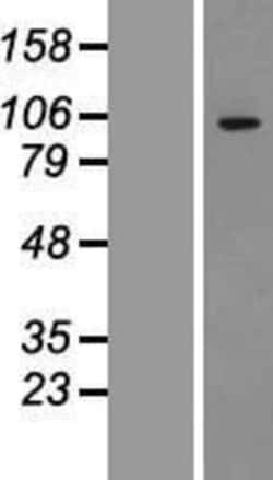 Novus Biologicals&trade;&nbsp;ADAMTS1 Overexpression Lysate