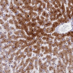 ADAMTS13 Antibody, Novus Biologicals 0.1mL; Unlabeled:Antibodies, Polyclonal