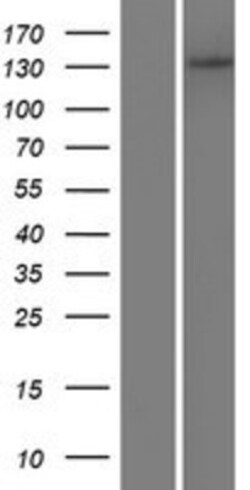 Novus Biologicals™ ADAMTS14 Overexpression Lysate