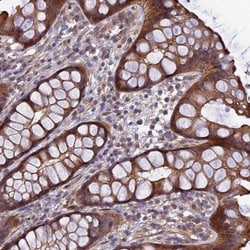 DAP12 Antibody, Novus Biologicals:Antibodies:Primary Antibodies