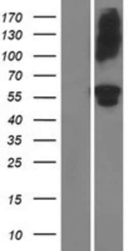Novus Biologicals ADAMTS16 Overexpression Lysate 0.1 mg | Buy Online | Novus Biologicals&trade; | Fisher Scientific