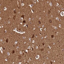 ADAMTS18 Antibody, Novus Biologicals 25 &mu;L; Unlabeled:Antibodies, Polyclonal