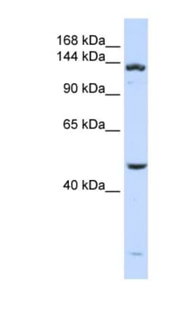 ADAMTS18 Antibody, Novus Biologicals:Antibodies:Primary Antibodies