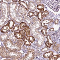 ADAMTS19 Antibody, Novus Biologicals 25 &mu;L | Buy Online | Novus Biologicals | Fisher Scientific