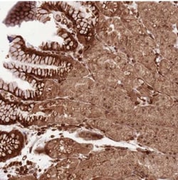 ADAMTS3 Antibody, Novus Biologicals 0.1mL; Unlabeled:Antibodies, Polyclonal