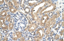 ADAMTS4 Antibody, Novus Biologicals 0.05mg; Unlabeled:Antibodies, Polyclonal