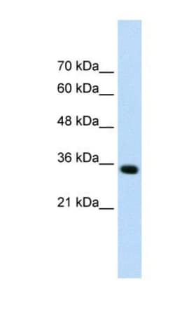 ADAMTS4 Antibody, Novus Biologicals 0.05mg; Unlabeled:Antibodies, Polyclonal