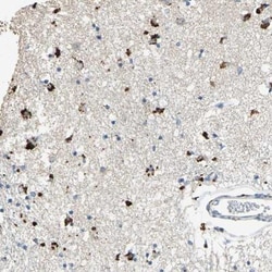 ADAMTS5 Antibody, Novus Biologicals 0.1mL; Unlabeled:Antibodies, Polyclonal