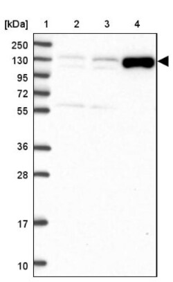 ADAMTS6 Antibody, Novus Biologicals 25 &mu;L, Unlabeled:Antibodies, Polyclonal