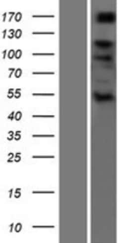 Novus Biologicals&trade;&nbsp;ADAMTS6 Overexpression Lysate