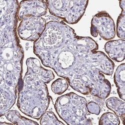 ADAMTS6 Antibody, Novus Biologicals 25 &mu;L, Unlabeled:Antibodies, Polyclonal