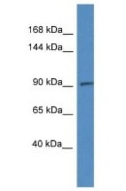 ADAMTS6 Antibody, Novus Biologicals:Antibodies:Primary Antibodies