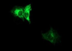 ADAMTS8 Antibody (OTI2H5), Novus Biologicals 0.1mL; Unlabeled:Antibodies