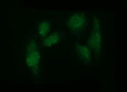 ADAMTS8 Antibody (OTI2H5), Novus Biologicals 0.1mL; Unlabeled:Antibodies