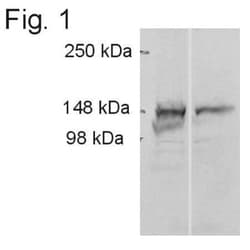 ADAMTS9 Antibody, Novus Biologicals 0.1mg; Unlabeled:Antibodies, Polyclonal