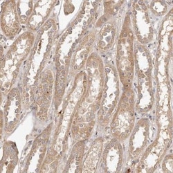 ADAMTS9 Antibody, Novus Biologicals 0.1mL; Unlabeled:Antibodies, Polyclonal