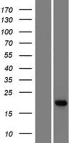 Novus Biologicals&trade;&nbsp;ADAT2 Overexpression Lysate