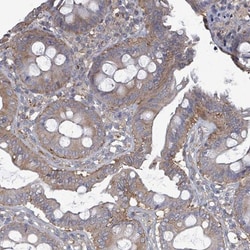 ADCK1 Antibody, Novus Biologicals:Antibodies:Primary Antibodies