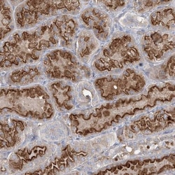 ADCK2 Antibody, Novus Biologicals 25 &mu;L | Buy Online | Novus Biologicals | Fisher Scientific