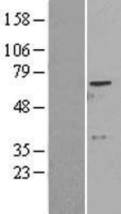 Novus Biologicals™ ADCK2 Overexpression Lysate